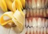See How To You Cab Use Banana Peel to Whiten Teeth In 6 Easy-To-Do Steps