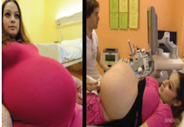 weird pregnancy
