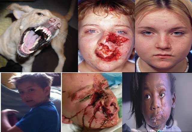 Safety Tips for Children and Dogs (DON'T BE A VICTIM) dog brute