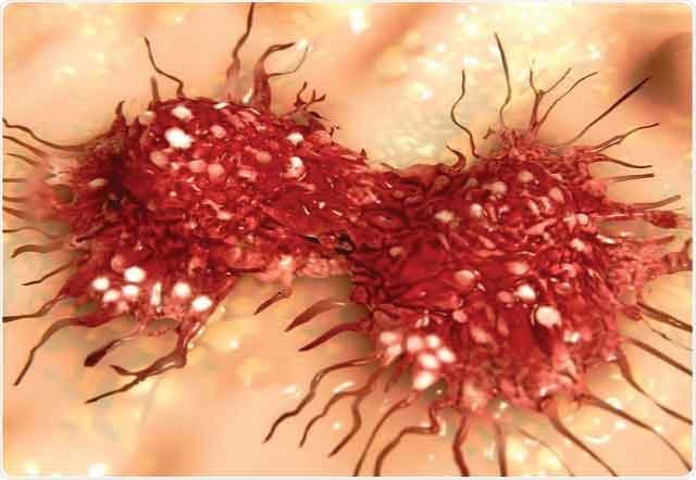If you Notice These 12 Signs, Chances are that you have Cancer and needs Doctor’s Attention Now
