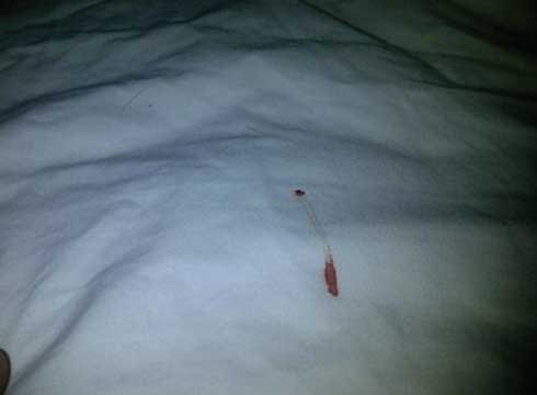 $700 to have their hymens restored