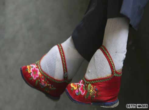 Binding feet to limit them from growing in China