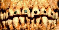 small holes made on their teeth and fitted those holes with gemstones
