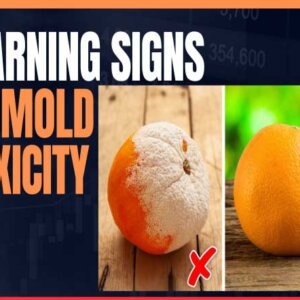 10 Warning Signs of Mold Toxicity You Should Never Ignore 10 Warning Signs of Mold Toxicity You Should Never Ignore