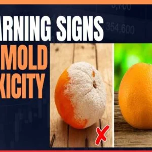 10 Warning Signs of Mold Toxicity You Should Never Ignore 10 Warning Signs of Mold Toxicity You Should Never Ignore