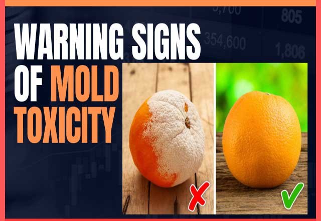 10 Warning Signs of Mold Toxicity You Should Never Ignore